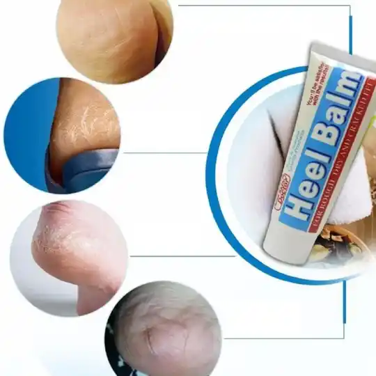 Skin Doctor Heel Balm Intensive Repair Cream 50g product photo